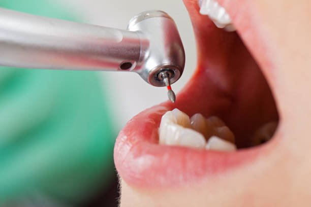 Best Emergency Dentist for Lost Fillings or Crowns in Pea Ridge, FL